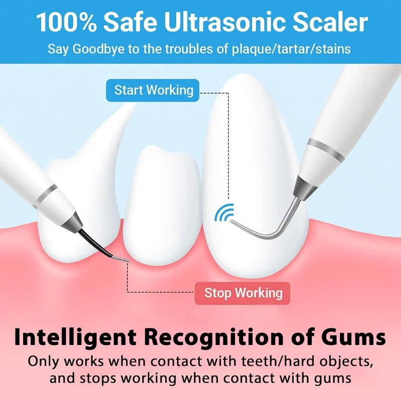 Dog Cat Grooming Smart Dental Ultrasonic Scaler Household Tooth Stone
